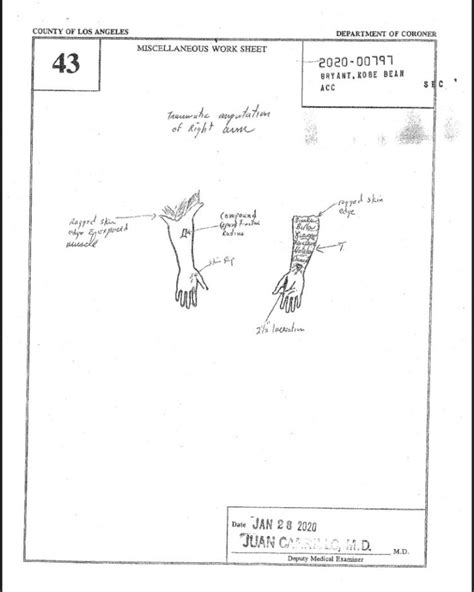 gigi and kobe autopsy|Gigi bryant autopsy report